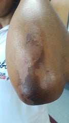 Wholesale 30ml labeled solution for hands and feet melanin treatment on elbow skin peeling