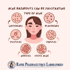 Illustration of different acne types including whiteheads, blackheads, pustules, papules, nodules, and cystic acne with a female face showing acne breakouts.