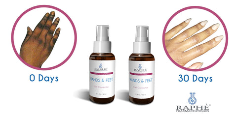 Wholesale Solution For Elbow, Hands & Feet Solution 250 Units of the 30ml